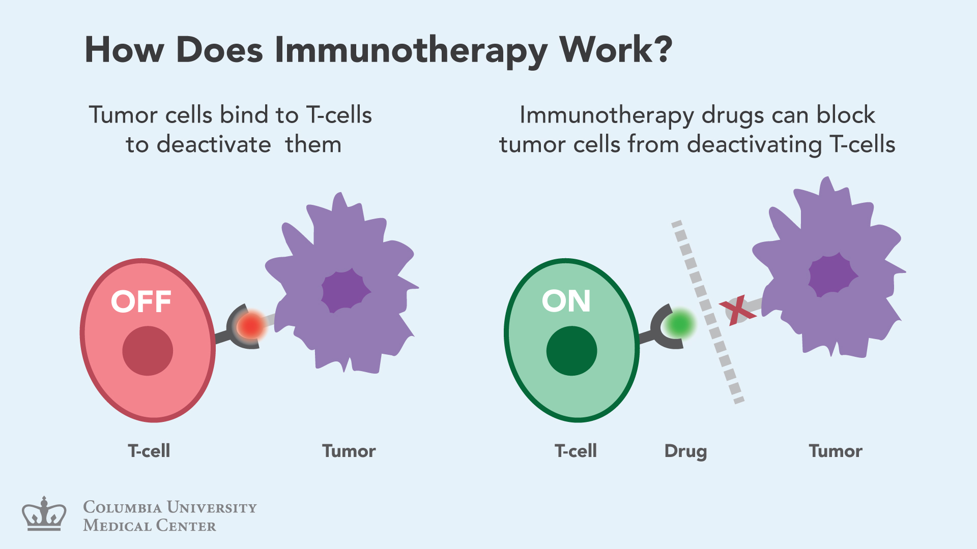 Immunotherapy