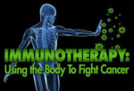 Immunotherapy