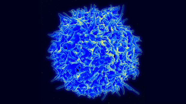 Immunotherapy: Curing Cancer By Immobilizing The Immune System