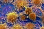 New Study Reveals Could Cause Excessive Tumor Growth